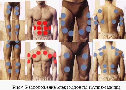 Расположение электродов по группам мышц